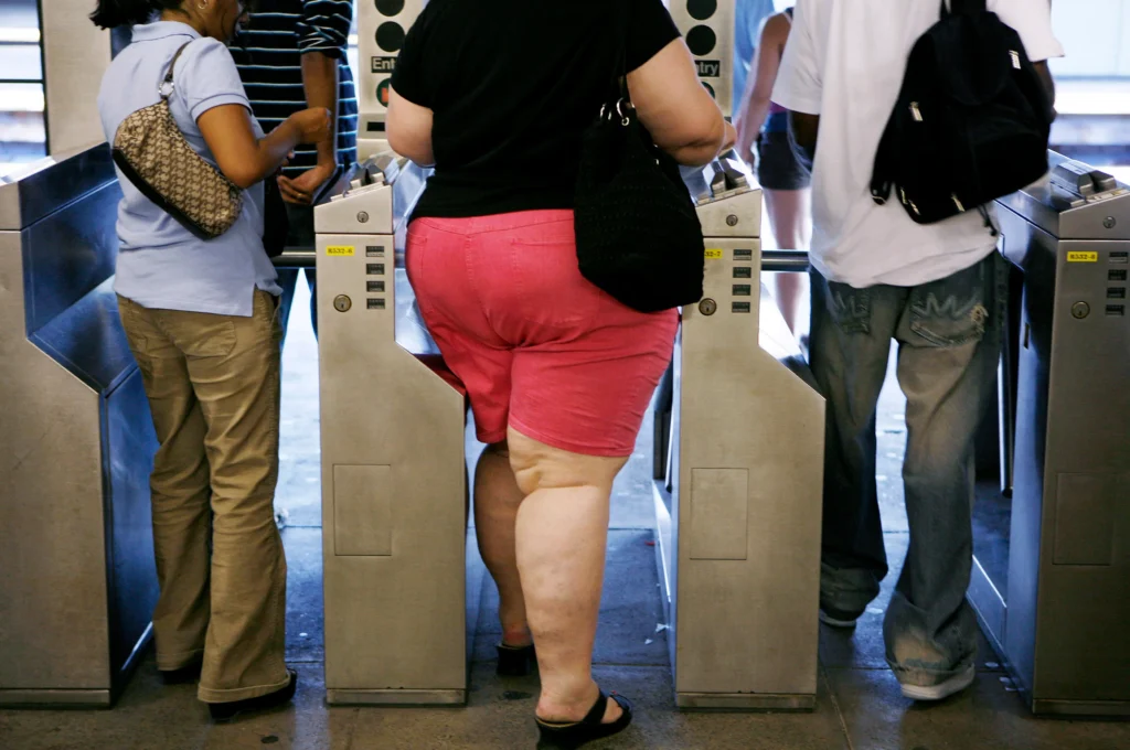 obesity