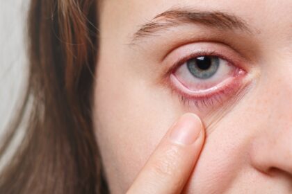 Glaucoma Awareness